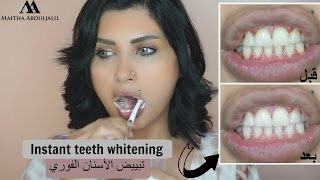 Instant whiter teeth remedy!   وصفة سحرية لتبييض الأسنان فور استخدامها