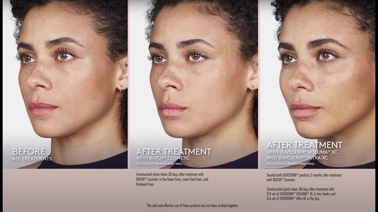 A Duo to Talk About: Before & After Video - Murielle - YouTube