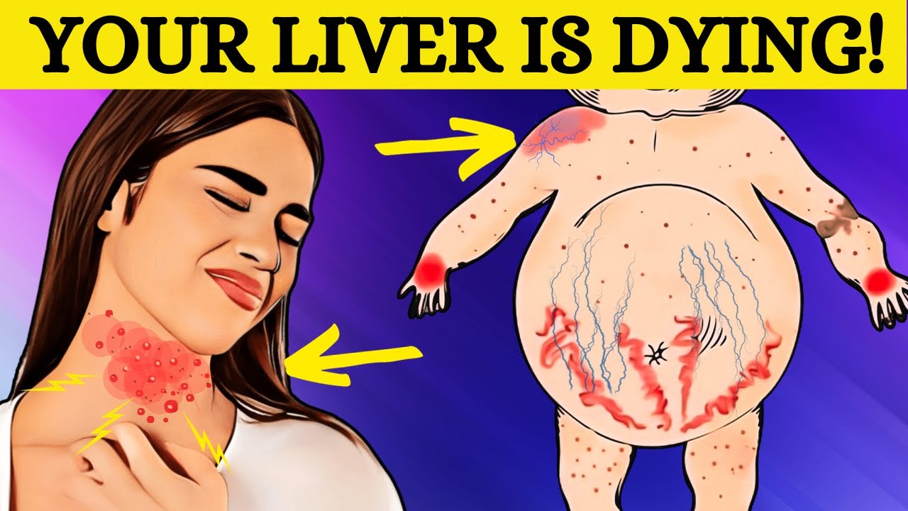 SILENT THREAT! These 8 Signs Could Indicate Fatty Liver Disease! - YouTube
