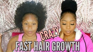 You Want Believe What I Did To Grow My Short Natural Hair Fast & Long With NO PILLS