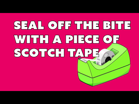 5-ways-to-deal-with-itchy-bug-bites