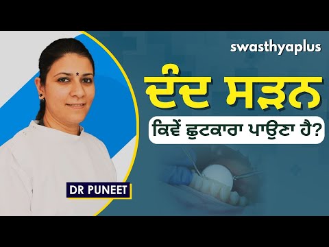 ਦੰਦ ਸੜਨ - ਕਿਵੇਂ ਛੁਟਕਾਰਾ ਪਾਉਣਾ ਹੈ? | Oral Cavity/ Tooth Decay in Punjabi | Dr Puneet