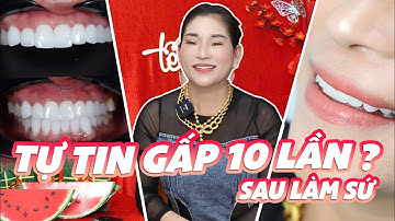 Hành Trình Lột Xác Nụ Cười - Chị Thanh Từ Đài Loan Rạng Rỡ Đón Tết 2025 | Nha Khoa Thanh Triều