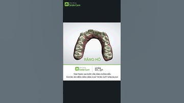 Niềng răng trong suốt Smilesalign - Niềng răng số 1 tại Việt Nam