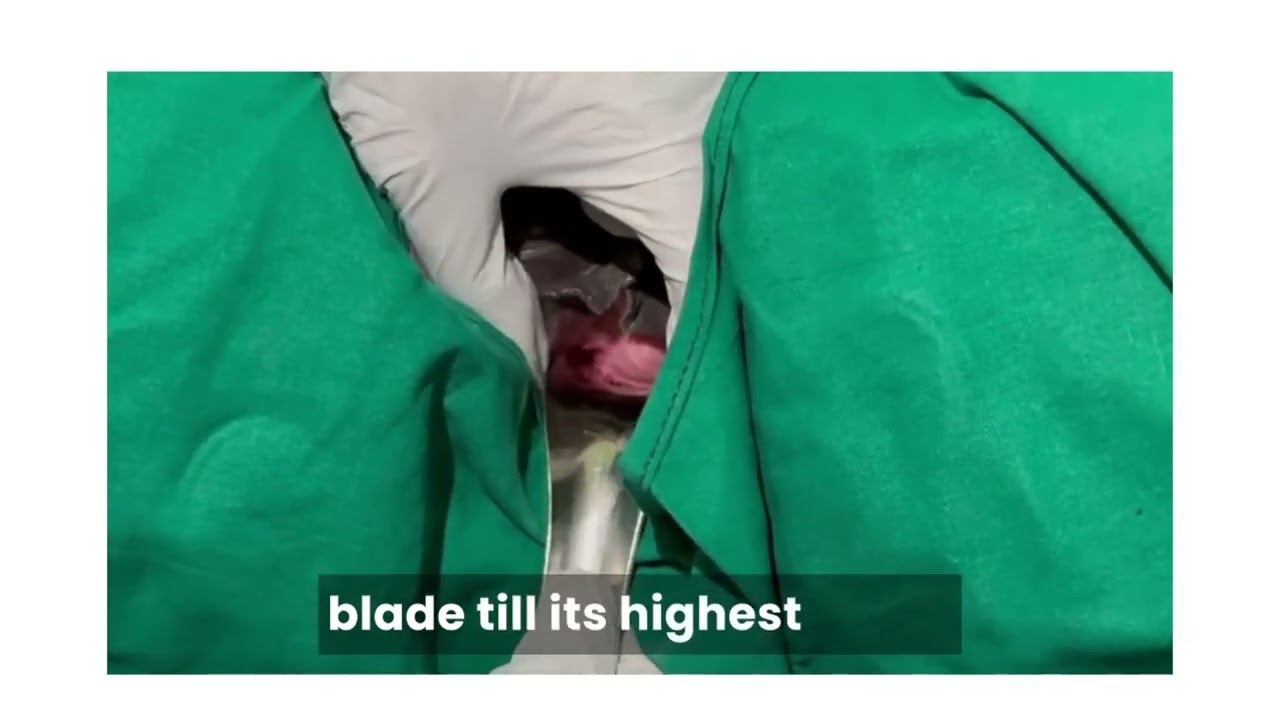 SPECULUM EXAMINATION (sims bivalved speculum)