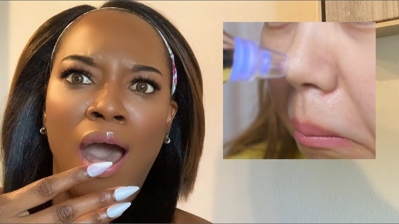 PORE VACUUMS?? How to Get rid of Blackheads SCIENTIST SEANKBEAUTY