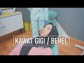 Part. 1 Prosedur Pemasangan Kawat Gigi / Behel - Konsultasi , foto gigi , dan cetak gigi