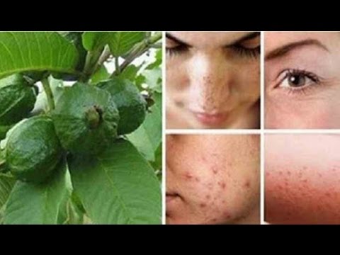 Daun Jambu Biji Hilangkan Jerawat Keriput Dan Flek Hitam Di Wajah 