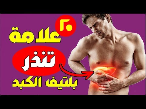 فيديو: تقليص نباتات البوكر الحمراء الساخنة: نصائح حول تقليم لعبة البوكر الحمراء الساخنة