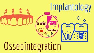 Osseointegration - Implantology - easy -  lecture - 5 min Dentistry