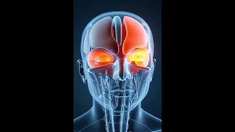 Inside the Brain: Thrombectomy Surgery in 3D #facts #science #shorts