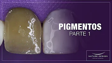 O que é mancha preta nos dentes?