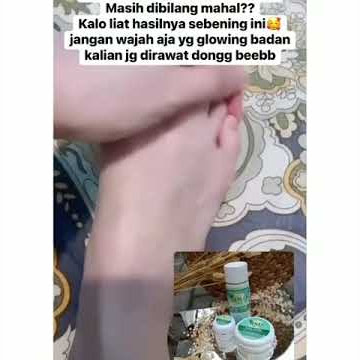 REAL TESTI PEMAKAIAN RSD SKIN GLOW ❤️