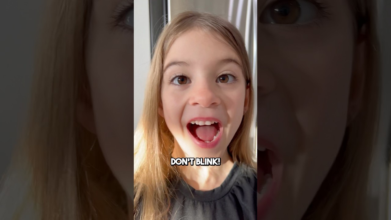 👀👀 STARING Contest! Can You Win⁉️🤗🤗🤪🤪