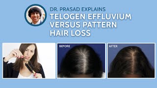 Differences Between Telogen Effluvium, and Genetic Pattern Hair Loss