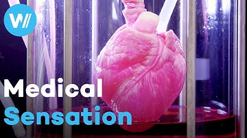 From Cardiac Arrest to the World