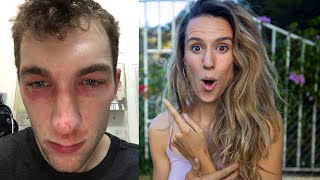 MY GIRLFRIEND DID THIS TO ME...and i was rushed to the emergency room