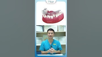 Những Trường Hợp Nên Niềng Invisalign | Bác Sĩ Yên