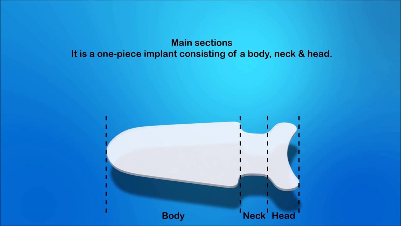 Animation of STARflo implant and surgical procedure