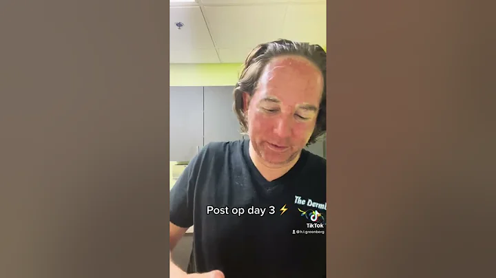 The Post CO2 Laser Treatment Healing Process at Las Vegas Dermatology Days 1-4