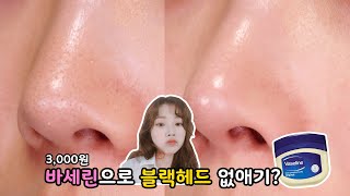 Will Vaseline and Cleansing Oil Eliminate the Nose Blackhead?⎮ Smile J