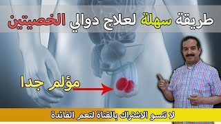 ما هو علاج دوالي الخصيتين