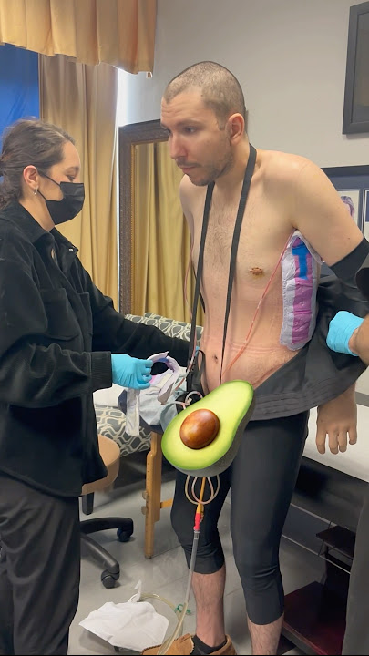 I survived FOUR Surgeries 🩸💉 Body Lift, Arm Lift, Thigh Lift, Torso Lift