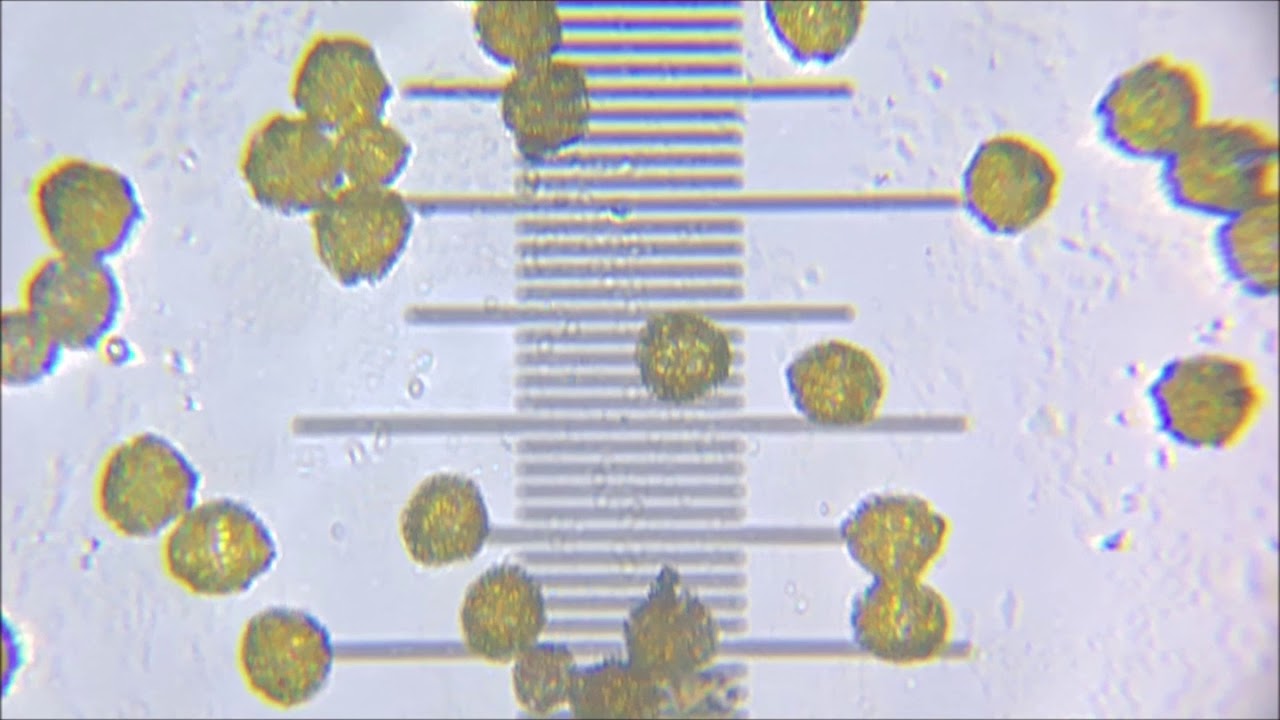 Dandelion pollen grains taken with DIPLE Grey and iPhoneX