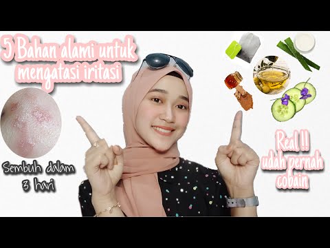 Video: 5 Obat Alami Untuk Membantu Menenangkan Kulit Iritasi