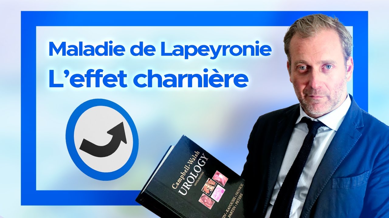 Maladie de Lapeyronie et effet charnière