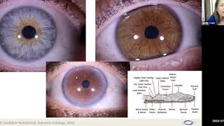 Detailed Eye Anatomy From the Perspective of an Iridologist Details