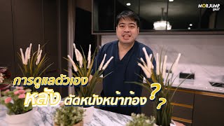 การดูแลตัวเองหลังตัดหนังหน้าท้อง