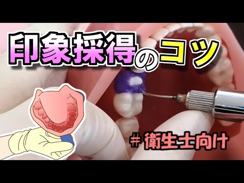 ㉖ 【寒天アルジ】印象採得のコツ！ - YouTube
