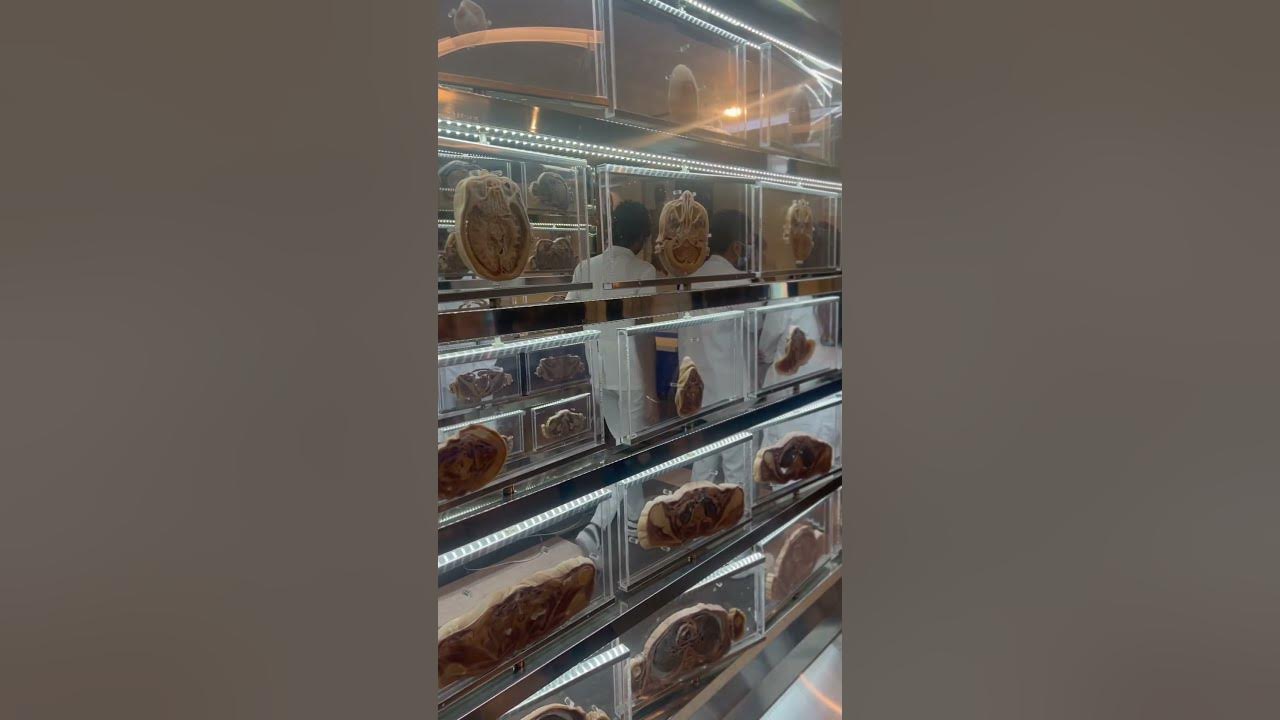 Plastinated real cadavers at dmsf anatomy lab. YouTube