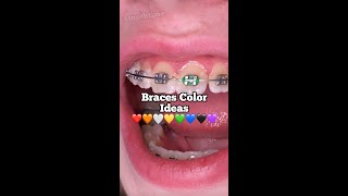 Braces Color Ideas - What is the best color for braces? - Tooth Time Family Dentistry New Braunfels