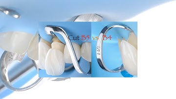 WHAT IS MY FAVOURITE RUBBER DAM CLAMP FOR ANTERIORS?