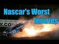 Nascar's Worst Injuries