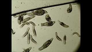 lehetséges a férgek azonosítása a malária plazmodium szöveti formáira ható gyógyszer