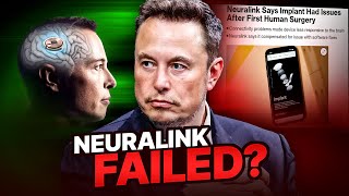 Elon Musk’s Neuralink is NOT worth it, or is it?  Neuralink fail #ai #neuralink #elonmusk