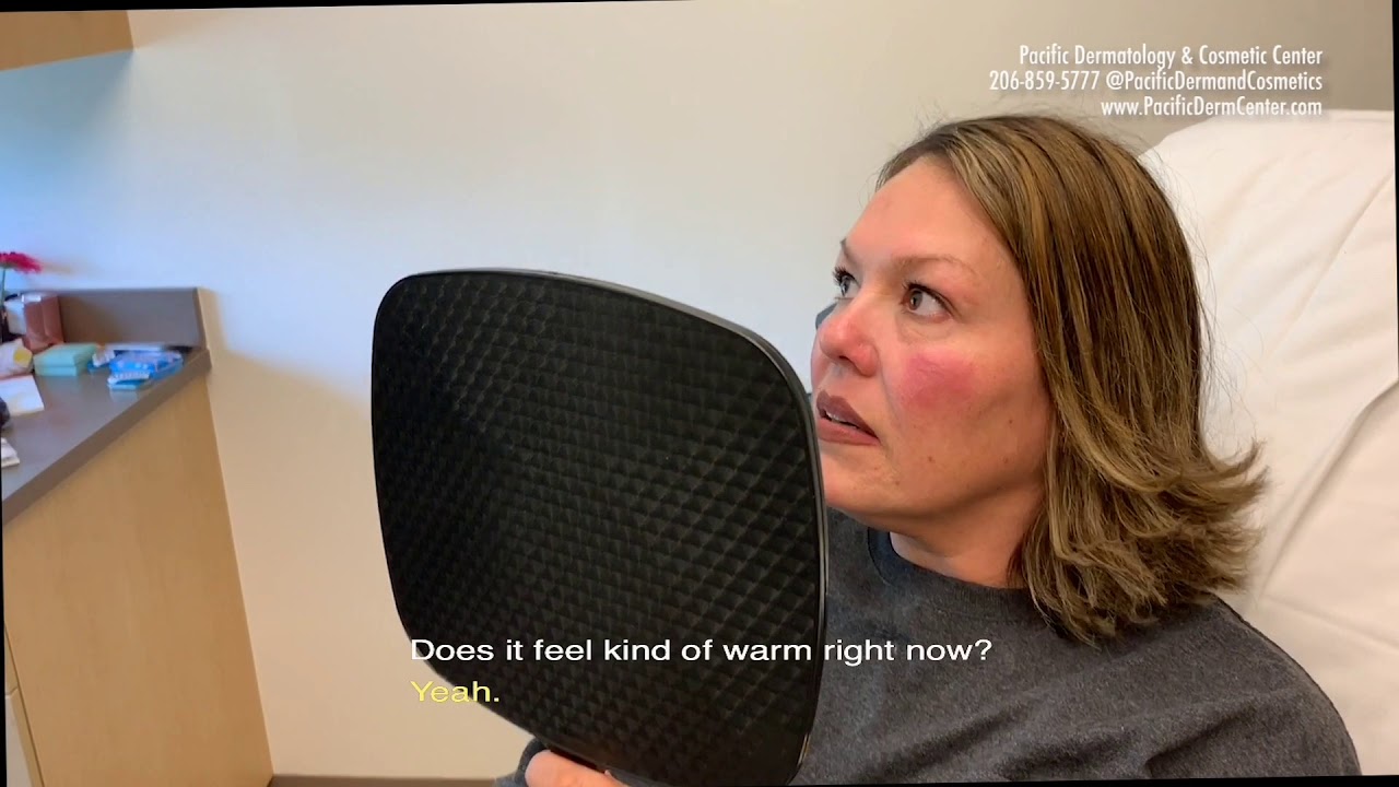 Does The KTP Laser Hurt? Patient Shares Her Experience YouTube