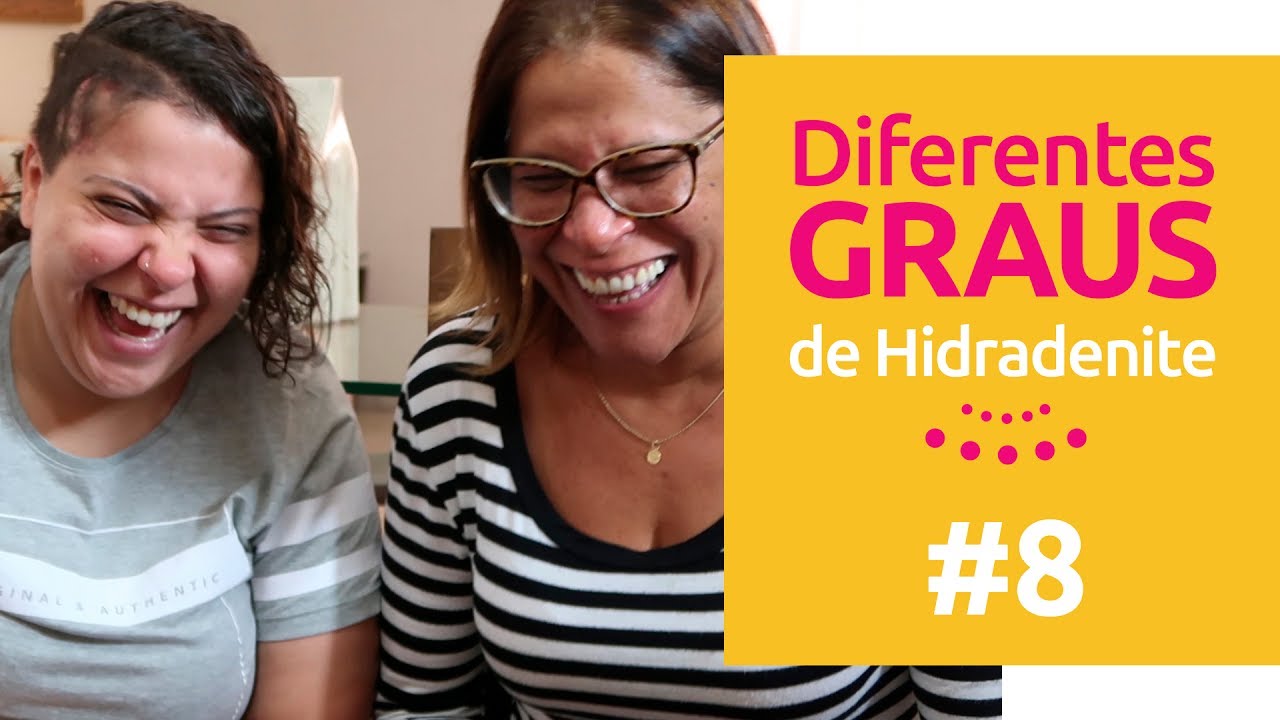 sofrimentos do jovem werther DIFERENTES GRAUS DE HIDRADENITE: Lulu, 52 anos | HS de Boa 08