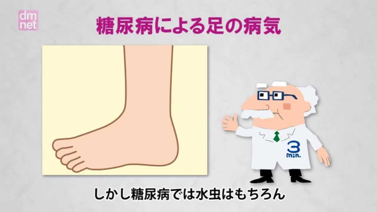 5 9 糖尿病と足の病気 糖尿病3分間ラーニング Youtube