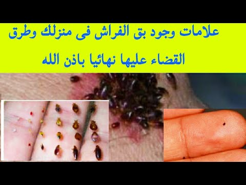 انتبه...3 علامات تدل على وجود بق الفراش (حشرة الفراش) فى منزلك والعلاج الفعال مره والنهائى باذن الله