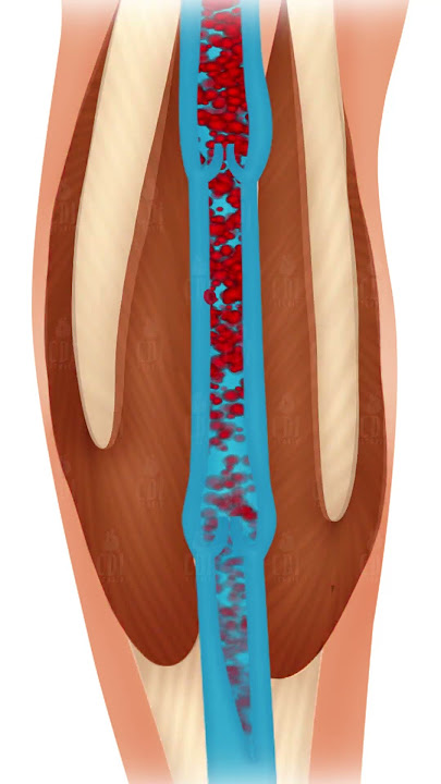 Boost Your Calf’s Blood Flow | 3D Animation for Better Circulation