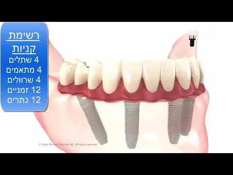 וִידֵאוֹ: איך משתילים ענבים? איך להשתיל באביב, בסתיו ובקיץ למקום חדש? השתלה נכונה של ענבים מבוגרים, זקנים וצעירים