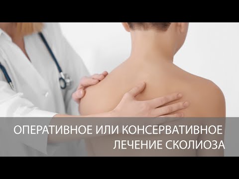 Оперативное или консервативное лечение сколиоза?