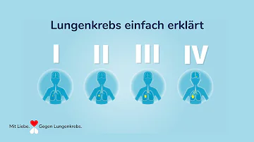 In welchem Stadium ist Lungenkrebs heilbar?