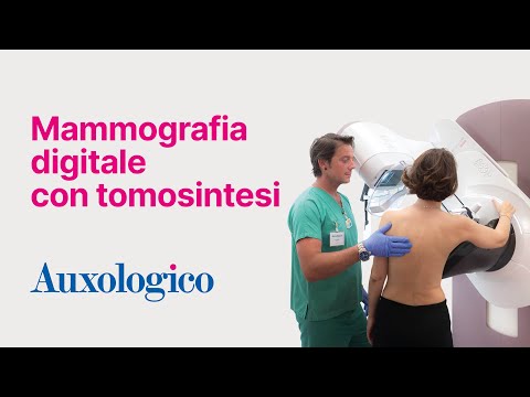 Mammografia digitale con tomosintesi in Auxologico