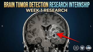 Medical Image Analysis - Brain Tumor Detection | AI internship | Research Internship Week-1