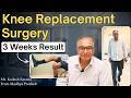 Knee Replacement Surgery: 3 Weeks Result |  TKR/ TKA knee Arthroplasty,Knee arthritis/pain Treatment